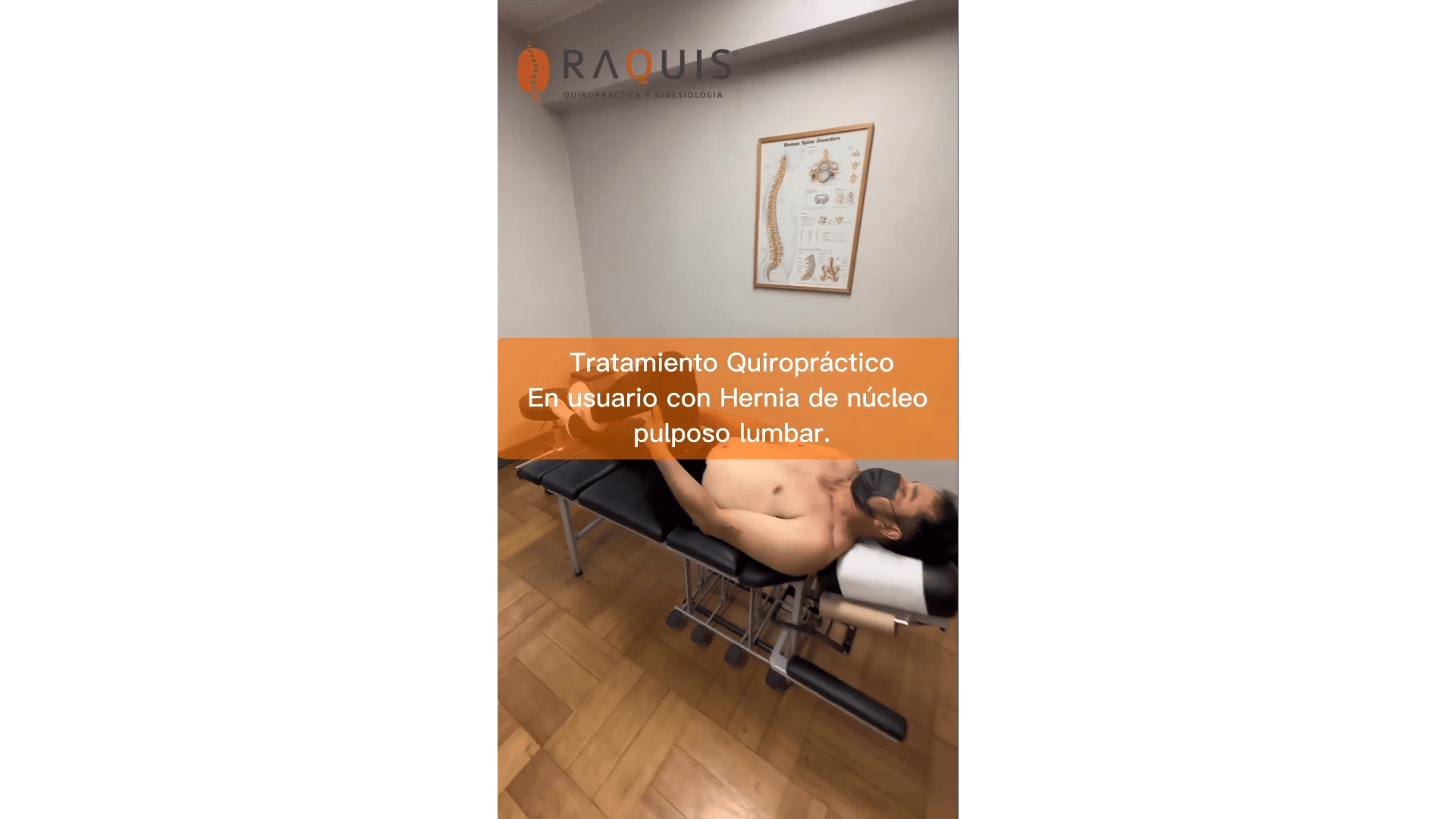 ¿Cómo aliviar el dolor de una hernia de núcleo pulposo lumbar? | La quiropráctica te puede ayudar